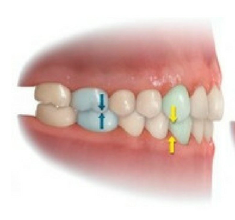 Oclusión y ATM Clinica Dental Carlos